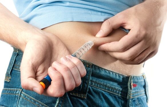 Súlyos 2-es típusú cukorbetegség esetén inzulin adása szükséges